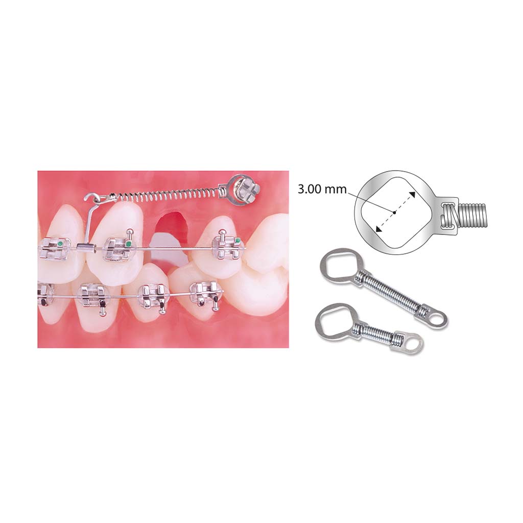 Ortho Technology TruFlex NiTi TAD Closed Coil Springs, 9mm(.010x.030"), Light Force 100gm, 10 pc/Pack